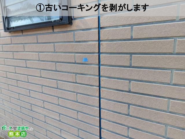 コーキング切除